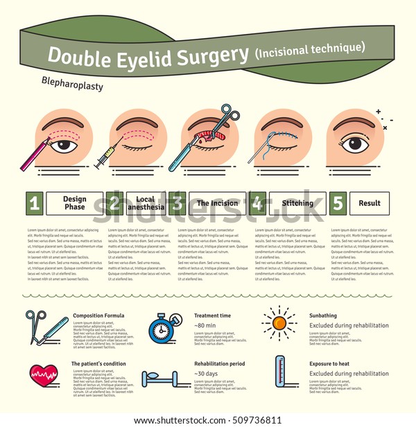 double eyelid surgery procedure