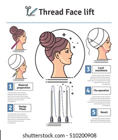 Vector Illustrated set with face lifting surgery by thread. Infographics with icons of plastic surgery procedures.