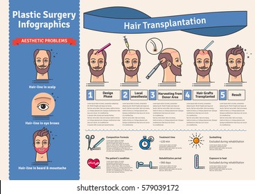 Vector Illustrated set with hair transplant surgery. Infographics with icons of plastic surgery procedures.