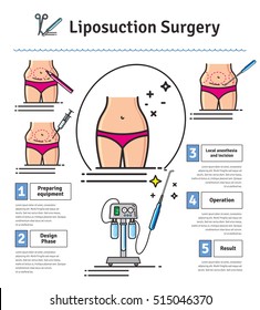 Vector Illustrated set with liposuction surgery. Infographics with icons of plastic surgery procedures.