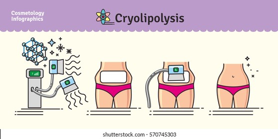 Vector Illustrated set with salon cosmetology Cryolipolysis treatment. Infographics with icons of medical cosmetic procedures for body.