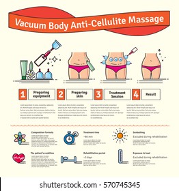 Vektorillustration Illustriertes Set mit Salon Vakuum Körper Anti-Cellulite Massage. Infografiken mit Symbolen der Prozeduren für den Körper.
