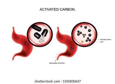 vector illustration of the action of activated carbon on toxins in the stomach.
