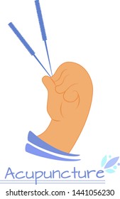 Vector illustration of acupuncture needles