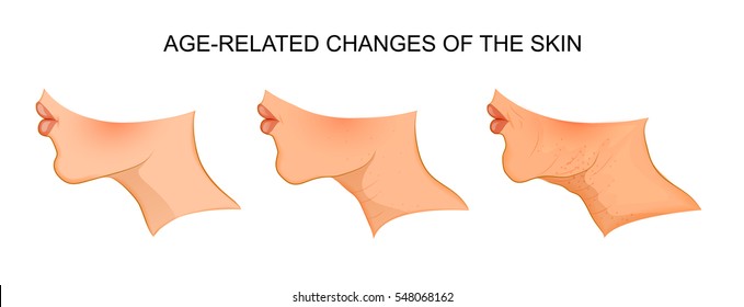 vector illustration of age-related changes. aging. for publications in medical journals