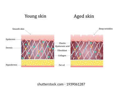 Vector Illustration Agerelated Changes Skin Comparison Stock Vector ...