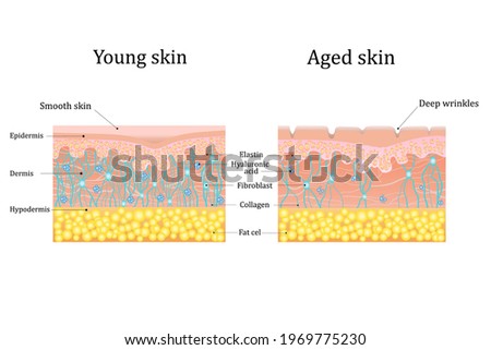 Vector illustration of age-related changes in the skin. Comparison of young and old skin. Structure human skin with collagen and elastin fibers, fibroblasts.