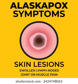 Vector illustration of Alaskapox symptoms with damaged skin close up