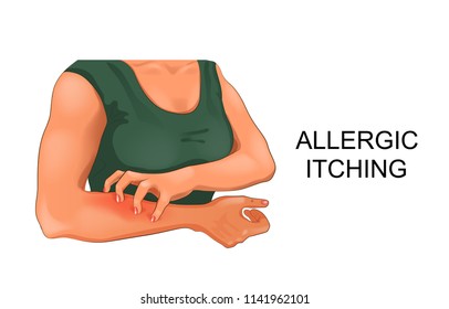 vector illustration of allergic itching of the skin