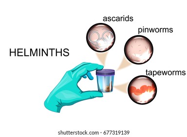 vector illustration of the analysis of a feces on eggs of worms