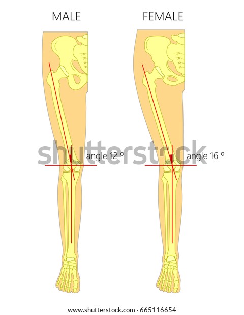 大腿骨と脛骨の間のq角を持つ 健康な人間の男と女の膝関節のベクターイラスト 脚の前面または正面図 広告や医療出版物用 Eps10 のベクター画像素材 ロイヤリティフリー