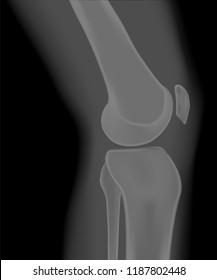 Vector illustration. Anatomy of a healthy knee joint, side, medial x-ray of the knee. For advertising and medical publications. EPS 10.