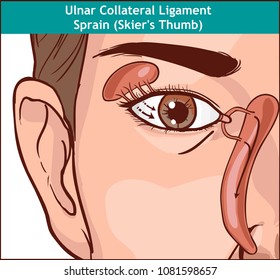 Vector illustration, anatomy of the Lacrimal apparatus