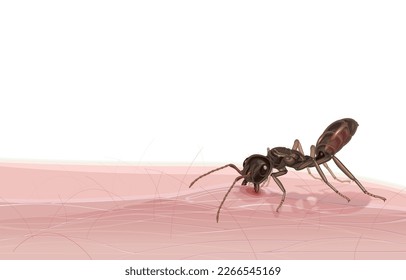 Vector illustration of angry worker ants biting human skin and splash citric acid,an attack from ant,defense against enemies attacking instinctively,isolated on white.invasive species,eusociality.
