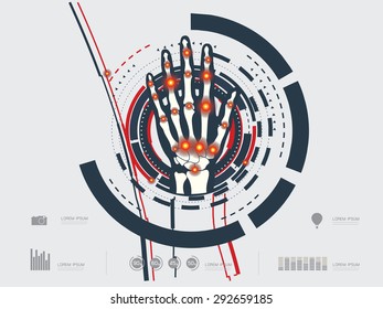 vector illustration of an arthritic hand