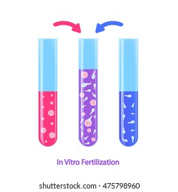 Vector illustration artificial insemination. In Vitro Fertilization in test tube ivf baby creation in laboratory.
