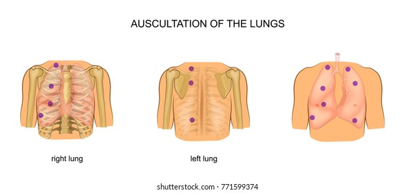 vector illustration of auscultation of the lungs
