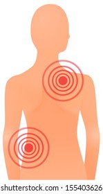 Vector illustration of back pain on shoulder and hip, treatment or massage concept