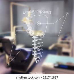 Vector illustration. Background - Blurred photo a dentist with a sketch - dental implants