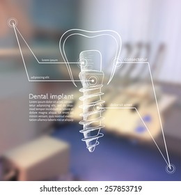 Vector illustration. Background - Blurred photo a dentist with a sketch infographics - dental implants