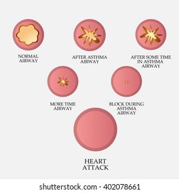 Vector illustration of a background for World Asthma Day.