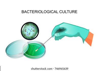 vector illustration of a bacteriological culture
