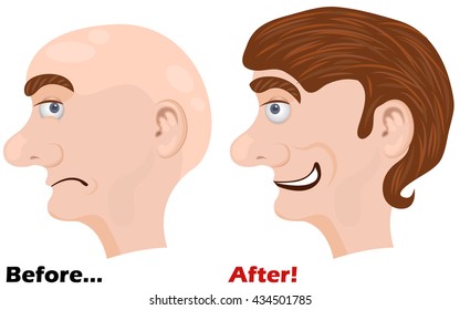 Vector illustration of before and after using a miracle lotion vector illustration - man head side face.