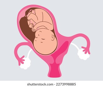 Vector illustration of bicornuate uterus during pregnancy. One uterine with fetus child and second cavity is empty and separated with septum