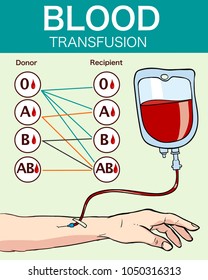  VECTOR ILLUSTRATION OF A BLOOD  TRANSFUSION