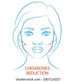 Vector illustration: blue contour hand drawn afro female face plastic surgery icon Cheekbones reduction isolated on white background
