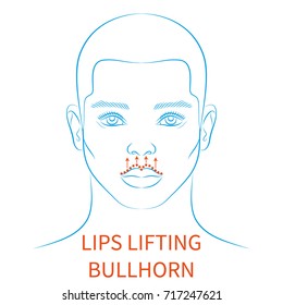 Vector illustration: blue contour hand drawn european male face plastic surgery icon with  lips lifting isolated on white background