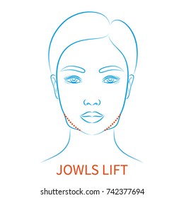 Vector illustration: blue contour hand drawn asian female face plastic surgery icon with inscription Jowls lift isolated on white background