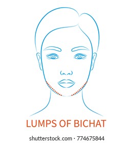 Vector illustration: blue contour hand drawn asian female face plastic surgery icon with inscription Lumps of bichat isolated on white background
