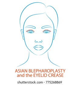 Vector illustration: blue contour hand drawn asian female face plastic surgery icon with inscription Asian Blepharoplasty and the eyelid crease isolated on white background
