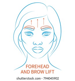 Vector Illustration: Blue Contour Hand Drawn Afro Female Face Plastic Surgery Icon Forehead And Brow Lift Isolated On White Background
