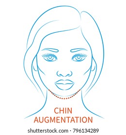 Vector illustration: blue contour hand drawn afro female face plastic surgery icon Beauty injections isolated on white background
