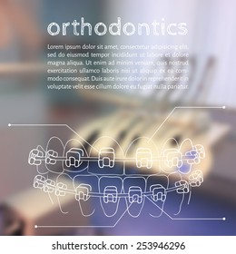 Vector illustration. Blurred background a dentist, with a sketch - Orthodontic treatment, Braces