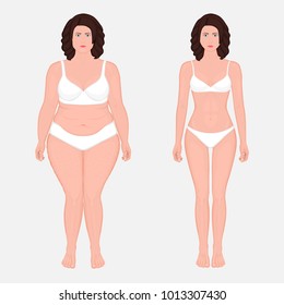 Vector illustration body weight loss in a European woman from obesity to normal. Front view. For advertising of cosmetic plastic procedures, stomach shunting, diet; medical publications. EPS 8.