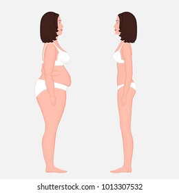Vector illustration body weight loss in a European woman from obesity to normal. Side view. For advertising of cosmetic plastic procedures, stomach shunting, diet; medical publications. EPS 8.
