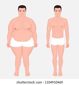 Vector illustration body weight loss in a European man from obesity to normal. Front view. For advertising of cosmetic plastic procedures, stomach shunting, diet; medical publications. EPS 10.