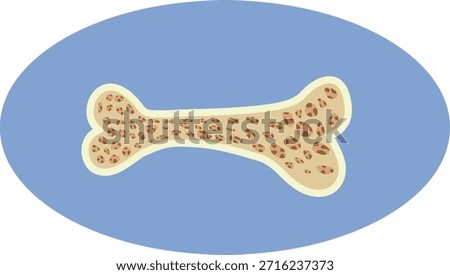 
Vector Illustration of a Bone Suffering from Aging and Osteoporosis. Porous brittle bone because of degenerative age related process    
