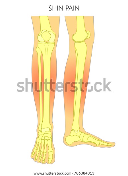 脛の痛みを伴う人の足の骨 前側と内側の視野 のベクターイラスト 広告 医療 医療 関連の出版物のベクターイラスト Eps10 のベクター画像素材 ロイヤリティフリー