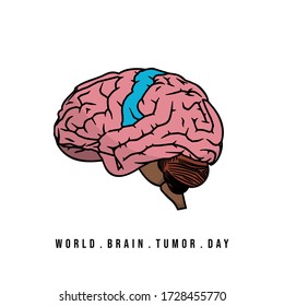 Ilustración vectorial del cerebro con diseño de concepto de tumor cerebral. bueno para el diseño del Día del Tumor Cerebro mundial.