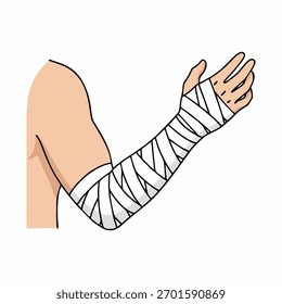 ilustração vetorial de um braço quebrado envolvido em uma bandagem elástica