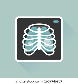 vector illustration chest x-ray image, lung radiography / pneumonia, pulmonary fibrosis / health care, safety equipment concept / flat, isolated, sign and icon template 