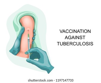 vector illustration of child vaccination against tuberculosis.