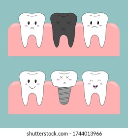 Vector illustration. The choice of images. Funny teeth. Teeth icons. Dental implants. Dental implant. Correction of teeth.