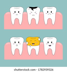 Vector illustration. The choice of images. Funny teeth. Teeth icons. Dental implant. Gold crown on the tooth. The correction of the teeth.