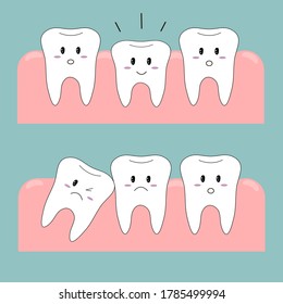 Vector illustration. The choice of images. Funny teeth. Teeth icons. Problems with the teeth. Abnormal development of the tooth. Caries. Correction of teeth.