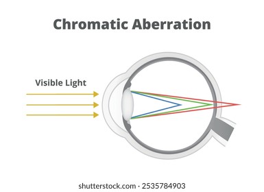 Ilustração vetorial da aberração cromática ou refração da luz no olho humano. Raios de comprimento de onda mais curtos são focados na frente da retina, raios de comprimento de onda mais longos são focados atrás da retina. 